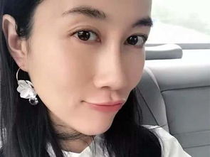 女演员贵州拍戏遇极端天气 胳膊受伤 女演员贵州拍戏遇极端天气 胳膊受伤