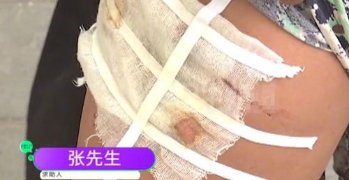 华为手机怎么大腿小腿 华为手机怎么大腿小腿